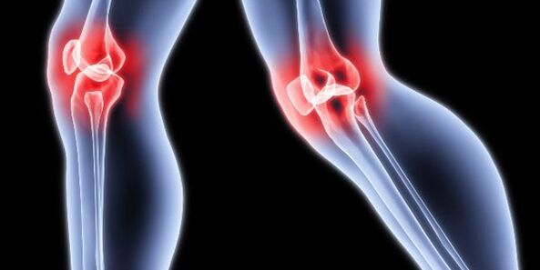 Knee articulation