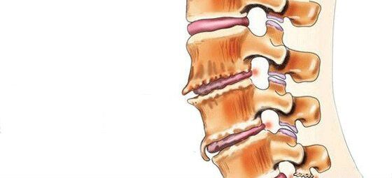 What is the vertebration