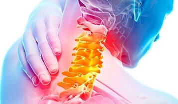Signs of cervical spine osteochondry