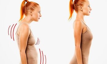 The reasons for the development of cervical osteochondicity