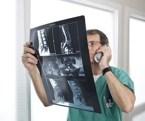 Myelography for the diagnosis of osteochondrosis and intervertebral hernias